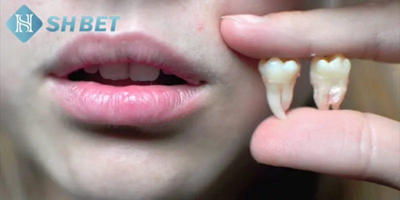 Bạn có thể giải mã giấc mơ thấy nhổ răng tại SHBET