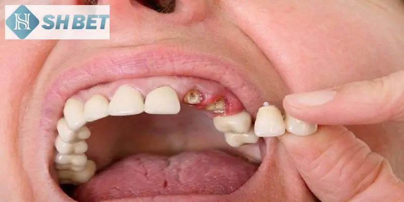 Việc nằm mơ rụng răng có ý nghĩa riêng tuỳ theo vùng miền