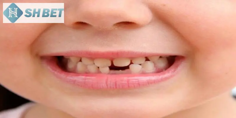 Cách nhìn của SHBET về giấc mơ rụng răng chi tiết, chuyên nghiệp